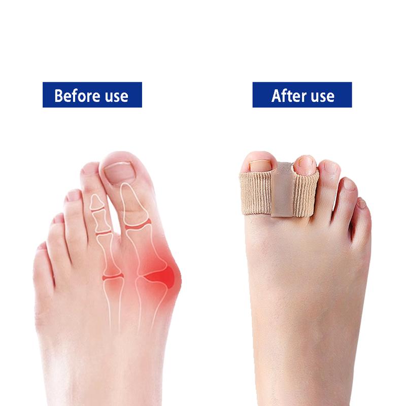 Woyuosn Premium Elastic Toe Separators – Comfortable Pain Relief & Alignment