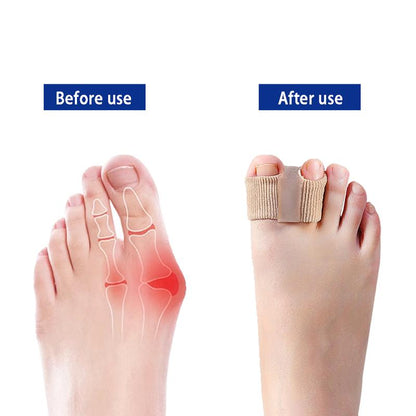 Woyuosn Premium Elastic Toe Separators – Comfortable Pain Relief & Alignment